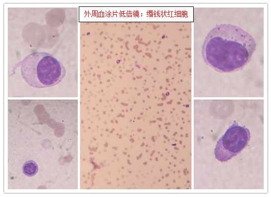 一例LPL/WM的发现之旅