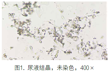 特殊形态草酸钙结晶的鉴别要点