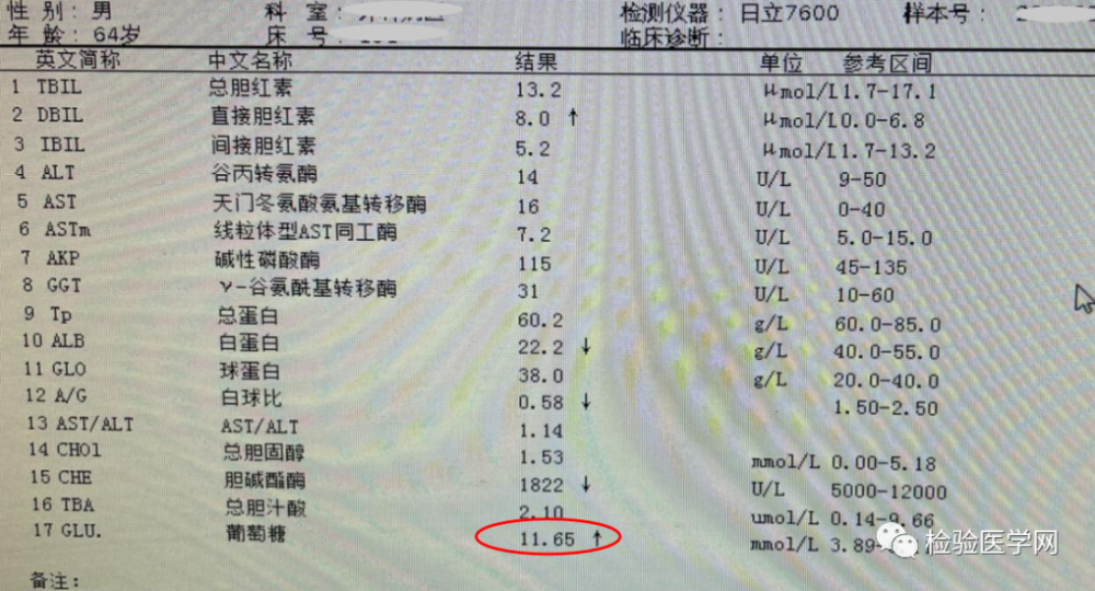 糖化血红蛋白假性降低，竟和“它”有关系？这个情况需警惕！