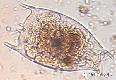 吓坏无数检验人的“怪物”，其实是……