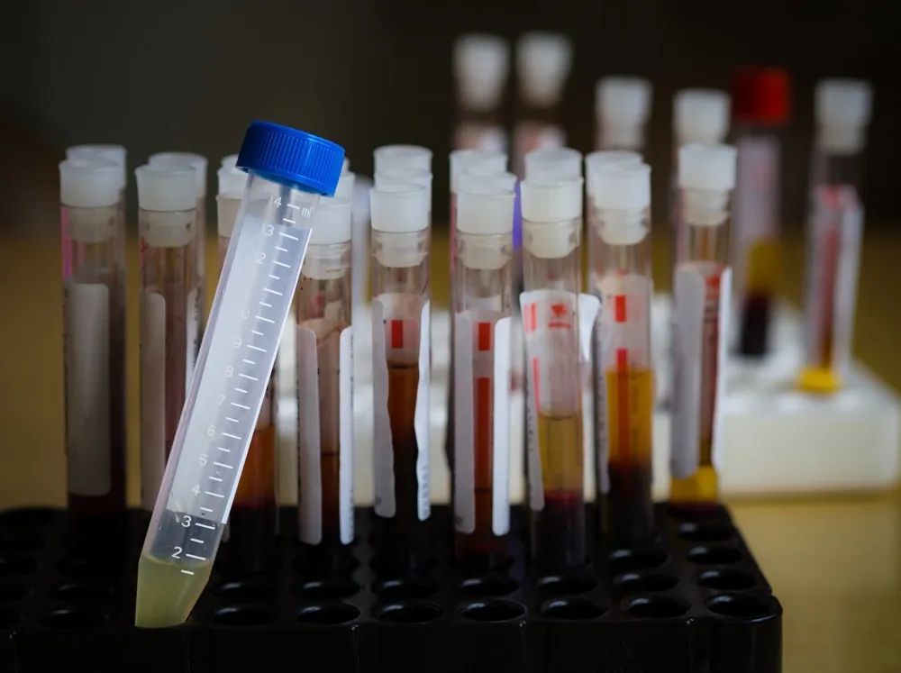 临床血液体液学室内质量控制的策划