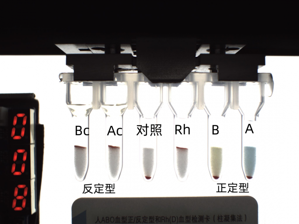 检验科血型鉴定无误，输血科配血却发现异常，怎么回事？