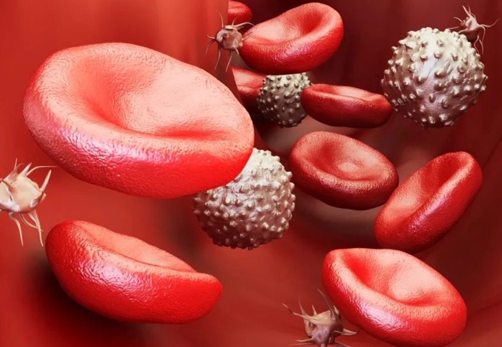 裂红细胞、大血小板复合干扰血小板检测，这种情况该如何处理？