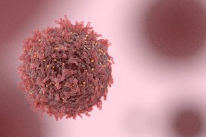 以HPV检测为基础的宫颈癌筛查方法