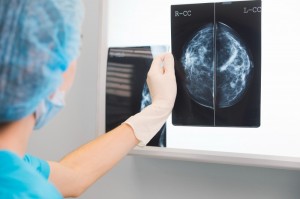 全球乳腺癌流行病学特点与诊断方法及预防措施