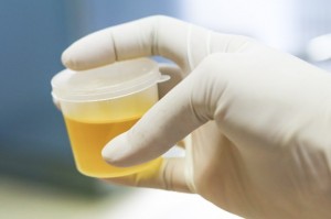 慢性肾损伤患者尿液中生物标志物的检测研究与临床验证