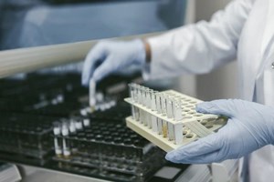 如何审核一张尿常规报告单