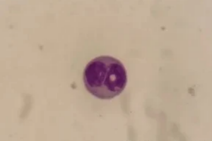 为啥要辨认生精细胞？