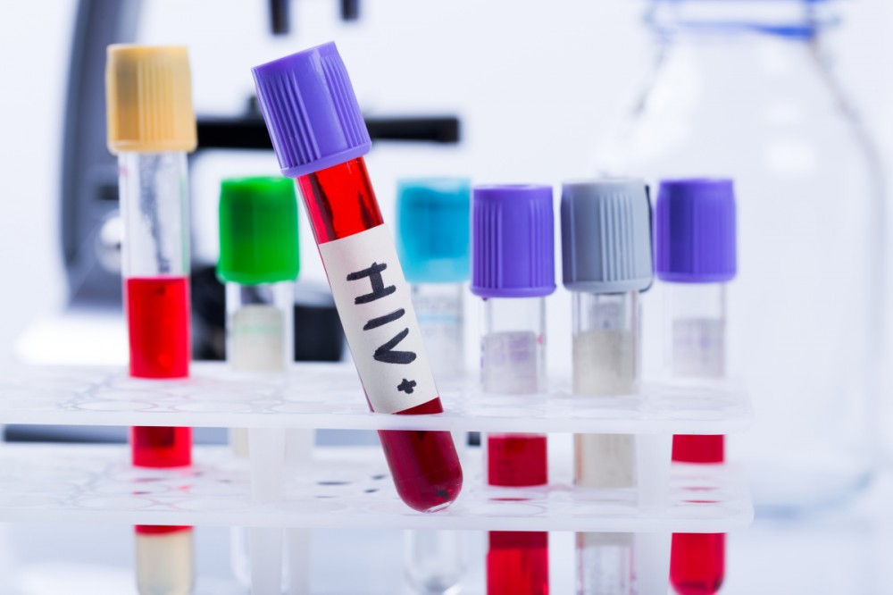 预防HIV感染新药来了！每年注射两次，有效率可达96%