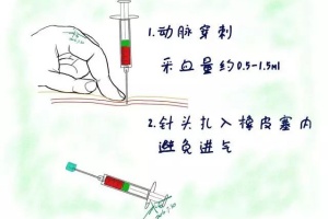 看完这篇，血气分析再也难不倒你了！