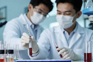 你的血脂指标真的高吗？当心“李鬼(LpX)”来捣乱