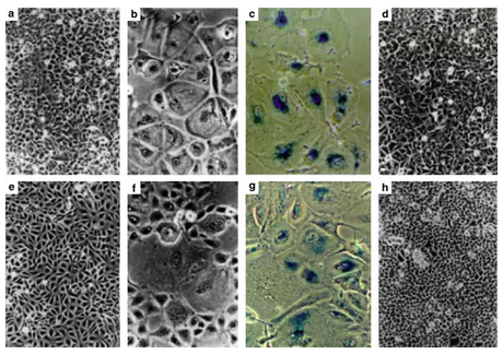 为什么癌症切除后，还会复发？