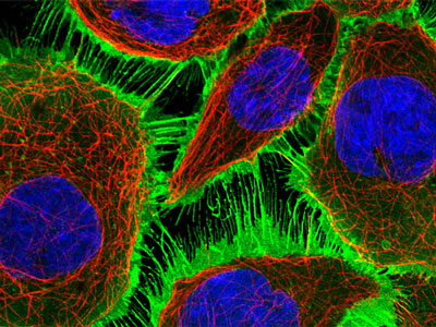 Science：大型蛋白质组项目结出硕果