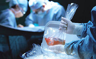 NEJM：艾滋病患者间可进行肾移植