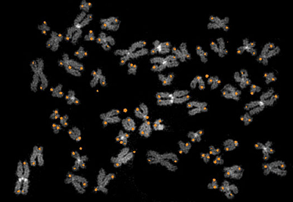 全基因组测序鉴定儿童恶性白血病基因重排