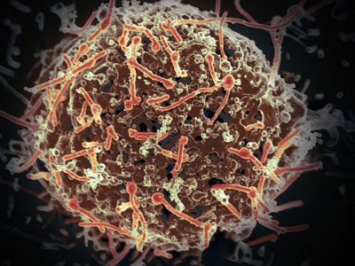埃博拉病毒引发一种强大的免疫应答