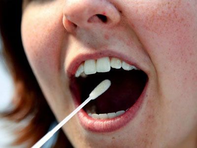 查唾液或可预测 感染流感风险