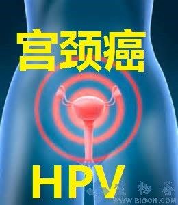 报告：2020年全球宫颈癌筛查市场将达到220亿美元