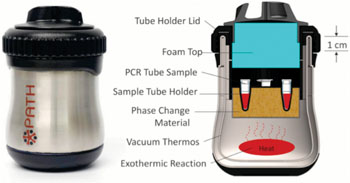 诊断HIV的低成本先进设备