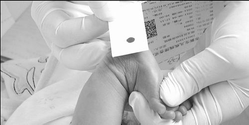 耳聋基因筛查：星火待燎原