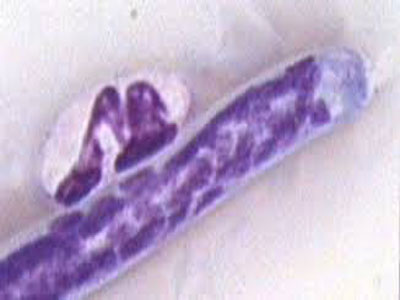 手机显微镜可发现血液中的寄生性蠕虫