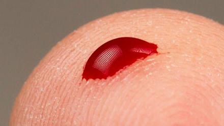 新技术VirScan可揭示一个人完整的病毒接触史