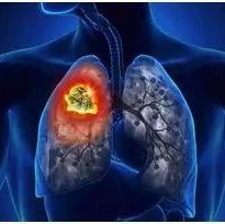 彻底颠覆肺癌筛查指南！检测血液中4种蛋白，精准预估肺癌风险！