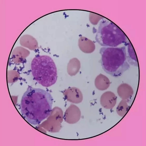 血片上的染色颗粒沉渣怎么快速去除？