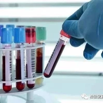 离奇的高血糖