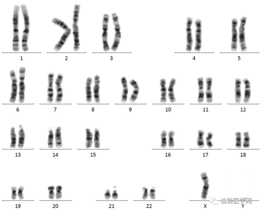 染色体核型分析G显带，浅带和深带哪个更重要?