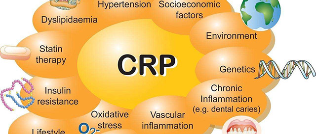 C反应蛋白的10大作用你知道吗？