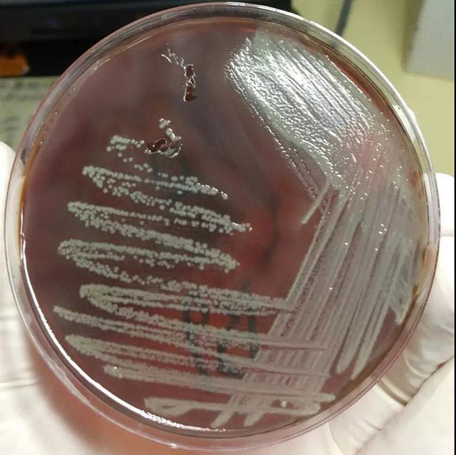 奇异变形杆菌把金葡菌吃了，怎么办？
