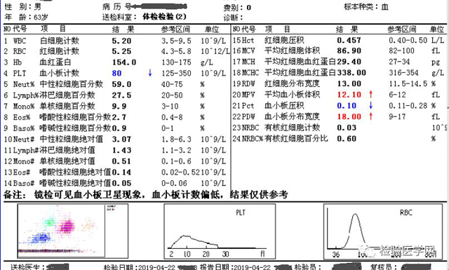 血小板去哪儿了？