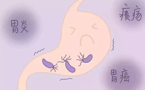 查了幽门螺杆菌，是不是就可以不用做胃镜？你可能一直搞错了！