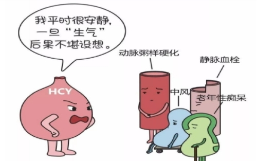 同型半胱氨酸你晓不晓得