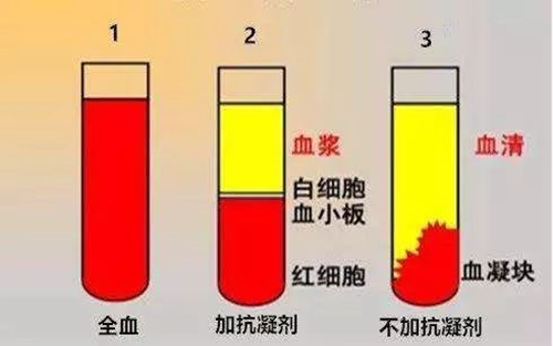 IVD检测项目使用全血、血清、血浆标本分类大汇总！