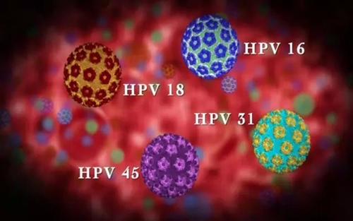 除了HPV16/18，中国女性最易感染致宫颈癌的居然是……