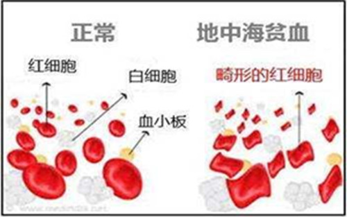 火眼金睛识地贫，基因检测现原形