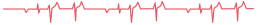 44.png